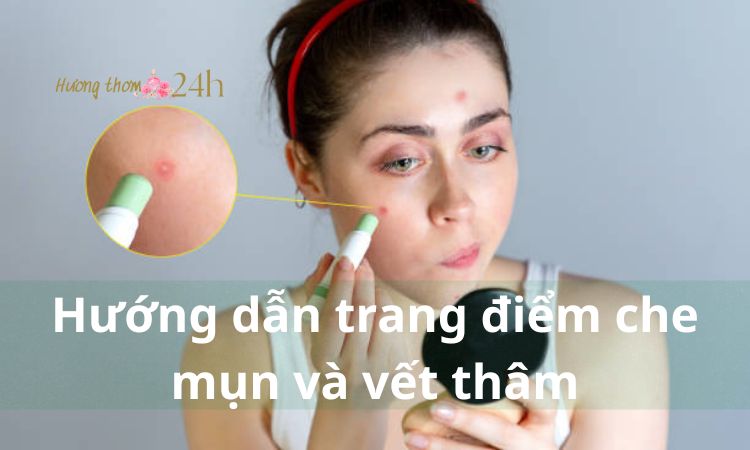 Hướng dẫn trang điểm che mụn và vết thâm