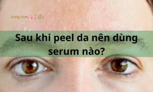 Sau khi peel da nên dùng serum nào?