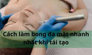 Hướng dẫn cách làm bong da mặt nhanh nhất khi tái tạo